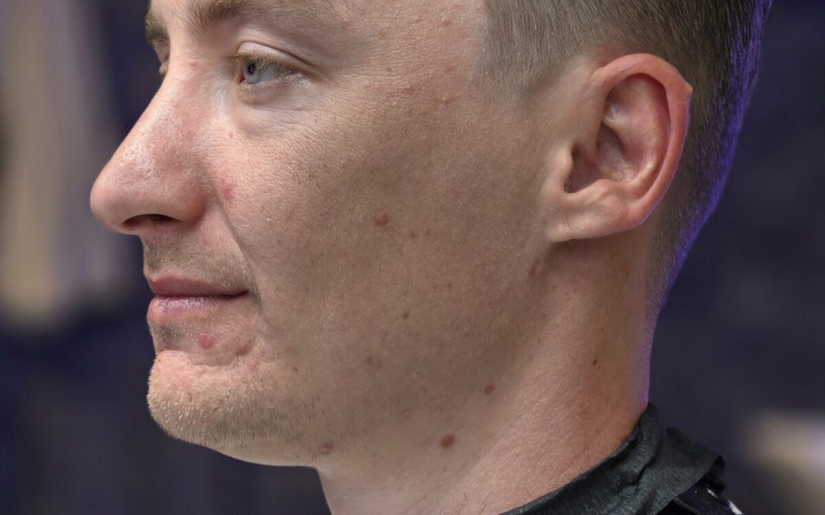 Beard Waxing Vs Shaving Amsterdam